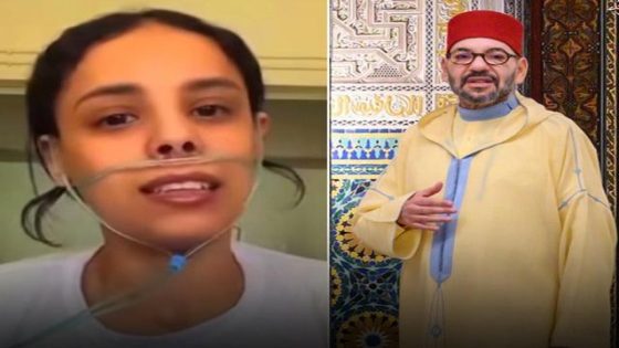 جلالة الملك يعطي تعليماته السامية بالتكفل بعملية زراعة رئة لشابة مريضة